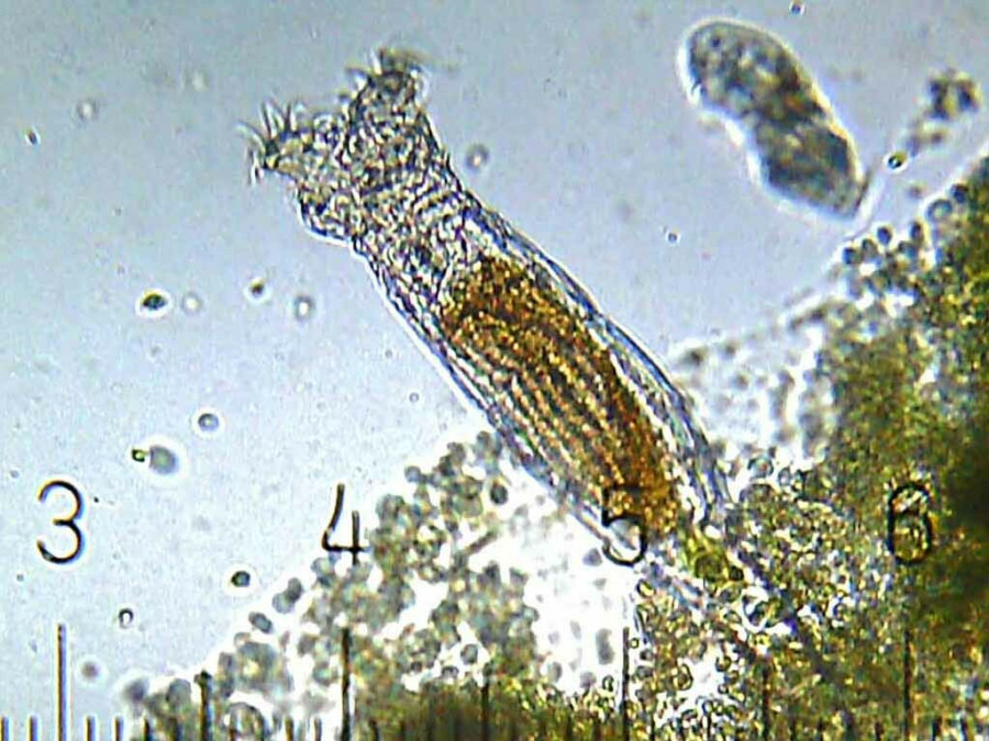 Bdelloid_Rotifer_3de01.jpg