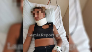 Θύμα άγριου ξυλοδαρμού 13χρονη από 17χρονες στη Λαμία: «Την δάγκωσαν στο πρόσωπο»