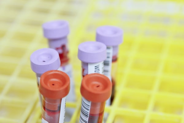 «Πράσινο φως» του FDA σε πρωτοποριακό τεστ αίματος για τον καρκίνο του παχέος εντέρου