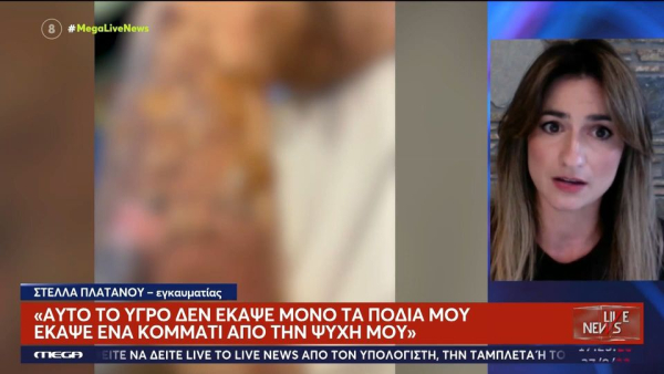 «Είναι σαν να μου πέταξαν μία βόμβα»: Χρησιμοποίησε αποφρακτικό και κάηκε, ο Γολγοθάς ένα χρόνο μετά