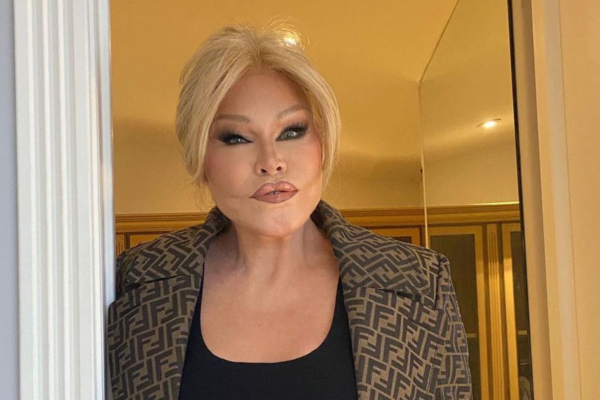 Η «Catwoman» Jocelyn Wildenstein αποκάλυψε το πραγματικό της πρόσωπο πριν τις αισθητικές επεμβάσεις