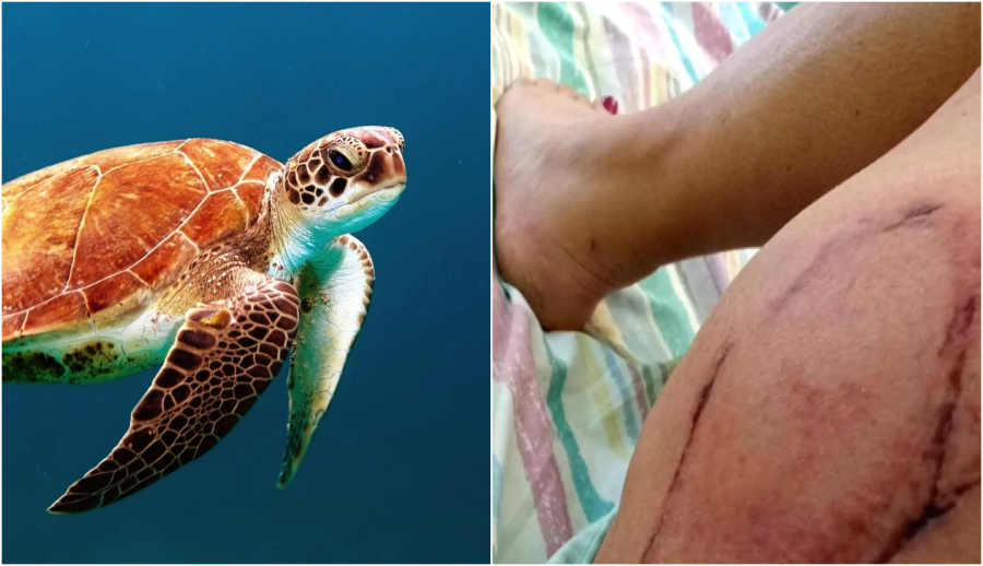 Νέα επίθεση θαλάσσιας χελώνας στη Μάνη: Η μαρτυρία λουόμενης και το «δάγκωμα»... χωρίς δόντια