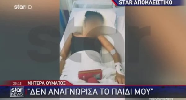 Χαλκίδα: Ξυλοκόπησε άγρια την 19χρονη σύντροφό του επειδή του ζήτησε να χωρίσουν