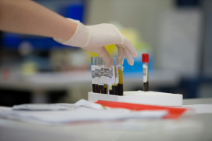 Ο FDA ενέκρινε εξέταση αίματος για το Αλτσχάιμερ