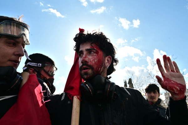 Στα Επείγοντα του «Γεννηματάς» 9 τραυματίες με χτυπήματα στο κεφάλι από το συλλαλητήριο