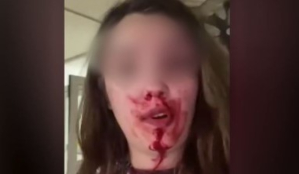 Σοκαριστικό βίντεο: 22χρονη περιγράφει αιμόφυρτη τον άγριο ξυλοδαρμό της από τον σύζυγό της στην Άμφισσα